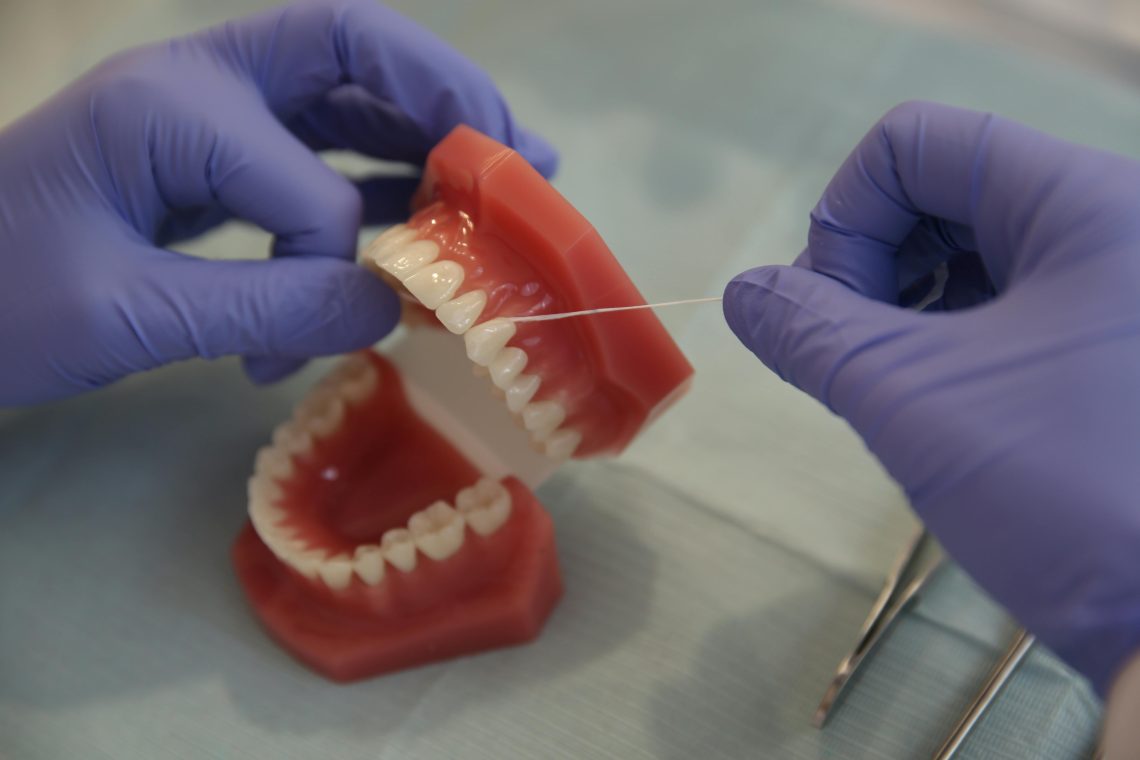 floss stuck in teeth