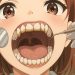 tartar teeth
