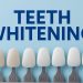 teeth whitening