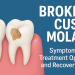 broken cusp molar