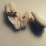 losing my teeth in 20s